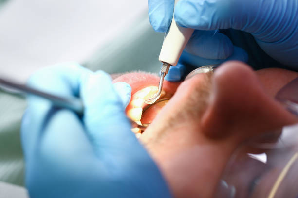 Best Emergency Orthodontic Repairs in Colorado City, TX